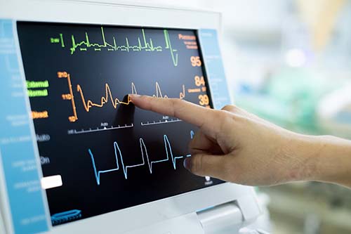 EKG Testing