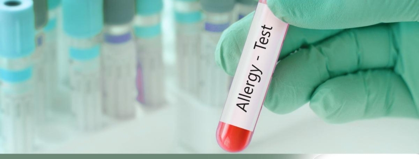 Allergy testing and treatment services in Phoenix Arizona