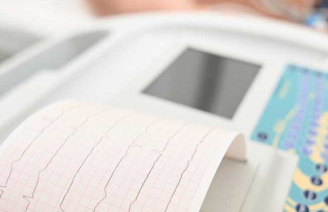 EKG testing services in Scottsdale Arizona