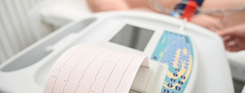 EKG testing services in Phoenix and Scottsdale Arizona